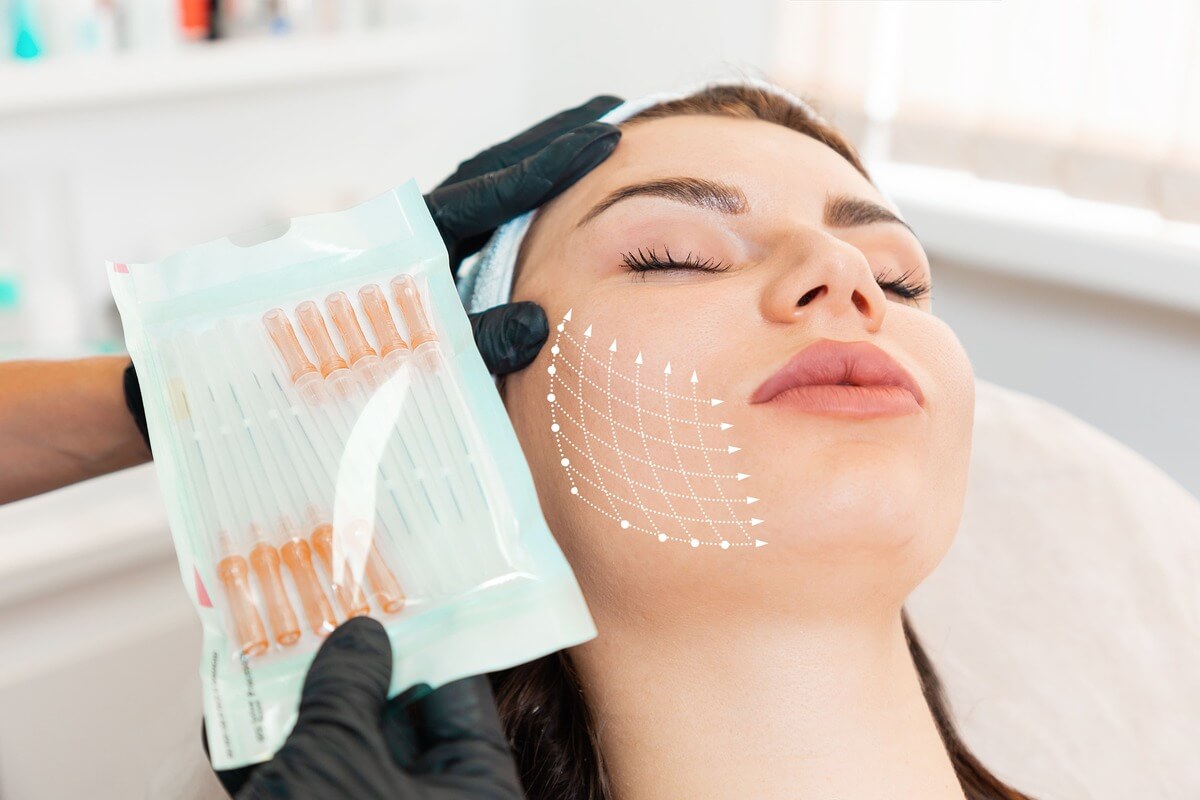 PDO Thread Lift for Neck and Jawline: Say Goodbye to Sagging Skin